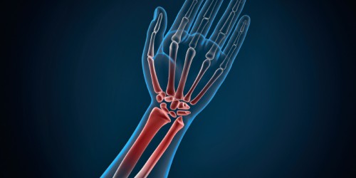 Types Of Spondylitis: Spondyloarthritis Vs Ankylosing Spondylitis